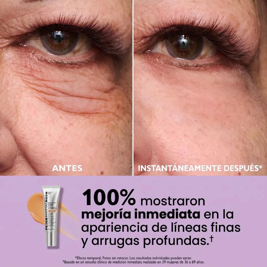 Instant FIRMx® Peter Thomas Roth Tensor de Ojos Temporal