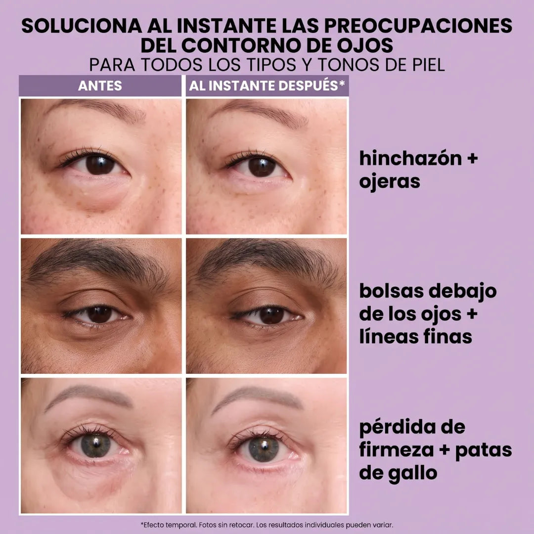 Instant FIRMx® Peter Thomas Roth Tensor de Ojos Temporal