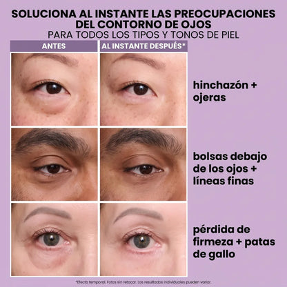 Instant FIRMx® Peter Thomas Roth Tensor de Ojos Temporal