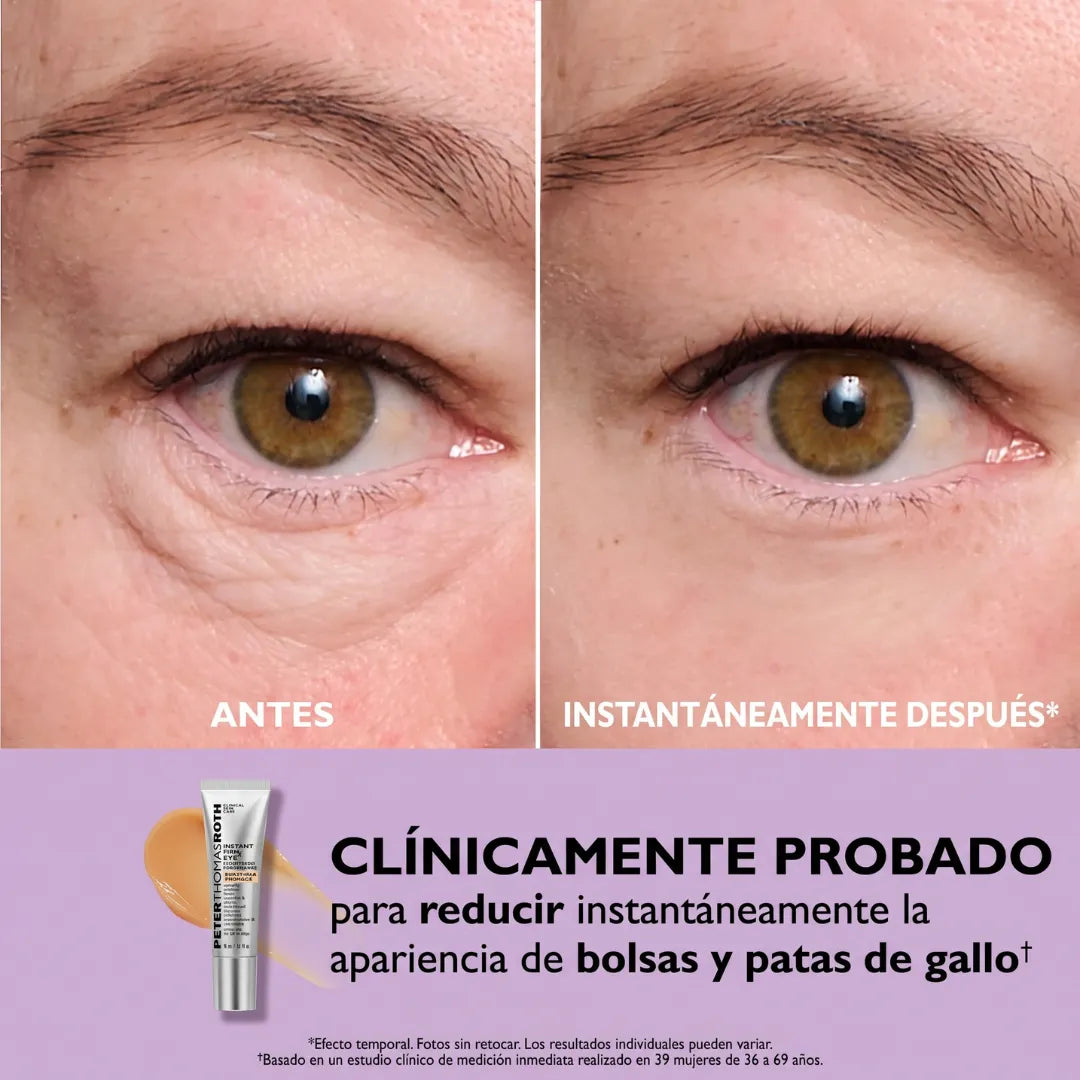 Instant FIRMx® Peter Thomas Roth Tensor de Ojos Temporal