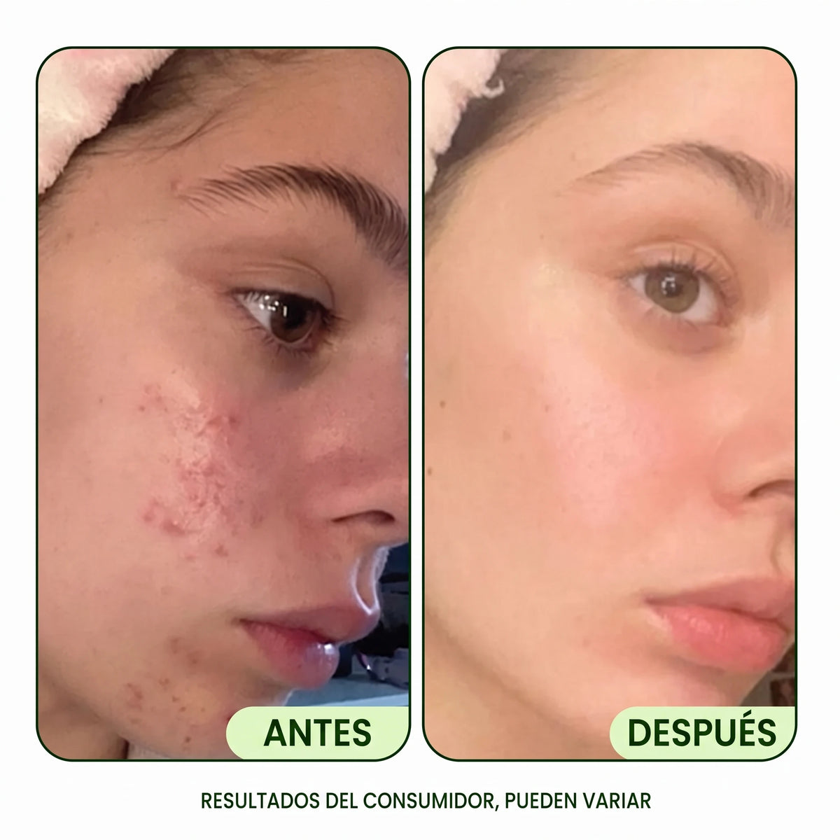 JiYu Tóner Pads Renovadores y Rejuvenecedores